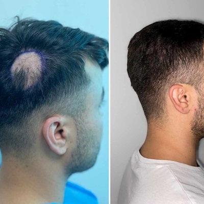 Scar Ekimi